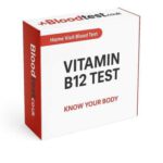 Vitamin B12 Blood Test for Residents of Guildford: Key Insights